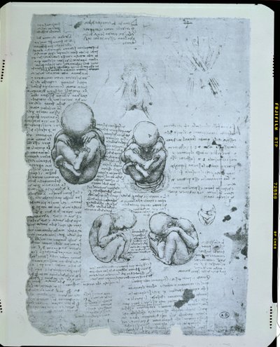 子宮内の胎児の5つのビュー、ファクシミリコピー 作： Leonardo da Vinci