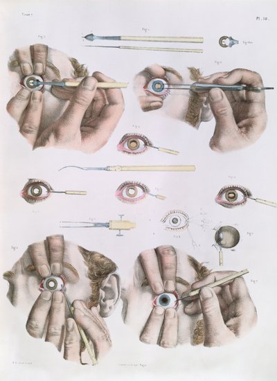 ジャン・バティスト・マルク・ブールジェリー（1797-1849）1866-67による「Traite Complet de l&39;Anatomie de l&39;Homme」の目、プレートの操作 作： Nicolas Henri Jacob