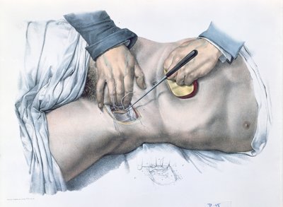 動脈を結ぶ、ジャン・バティスト・マルク・ブールジェリー（1797-1849）1866-67による「Traite Complet de l&39;Anatomie de l&39;Homme」のプレート 作： Nicolas Henri Jacob
