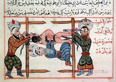 骨折の縮小。シャラフ・アル＝ディンのトルコ医学書のミニチュア 作： Ottoman School