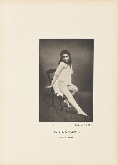 子宮てんかん性拘縮 作： Paul Marie Léon Regnard