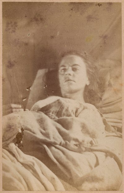ヒステリーてんかん、発作、第3期、プレートXXVI、「Iconographie Photographique de La Salpetriere」Bourneville et P. Regnard、パリ、1876年（アルブメンプリント） 作： Paul Regnard