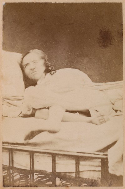 ヒステリーてんかん、ゆがみ、プレートXXXVIII、「Iconographie Photographique de La Salpetriere」Bourneville and P. Regnard、パリ、1876（アルブメンプリント） 作： Paul Regnard