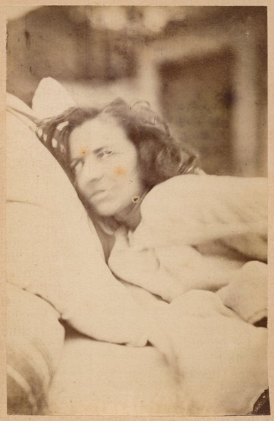 ヒステリーてんかん、せん妄、欲望、プレートXXXVI、「Iconographie Photographique de La Salpetriere」Bourneville and P. Regnard、パリ、1876（アルブメンプリント） 作： Paul Regnard