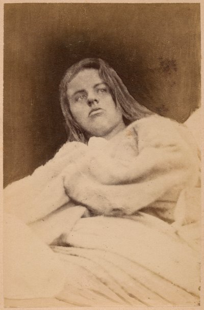 ヒステリーてんかん、幻覚、軽蔑、プレートXXXIの「Iconographie Photographique de La Salpetriere」、Bourneville and P. Regnard、パリ、1876（アルブメンプリント） 作： Paul Regnard