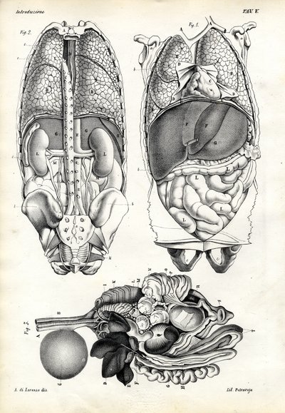 腸、1863-79 作： Raimundo Petraroja