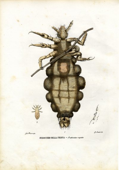 シラミ、1863-79 作： Raimundo Petraroja
