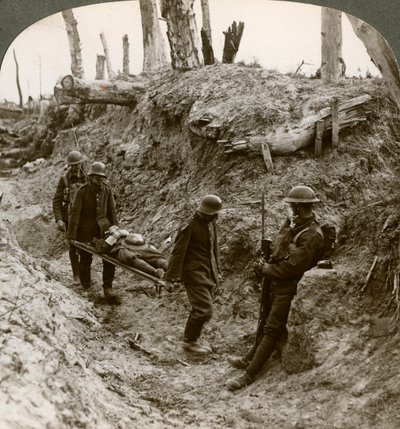 イギリス人を負傷させたドイツ人捕虜、第一次世界大戦、1916年。 作： Realistic Travels Publishers