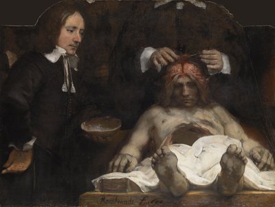 ヤンデイマン博士の解剖学レッスン、1656年 作： Rembrandt van Rijn