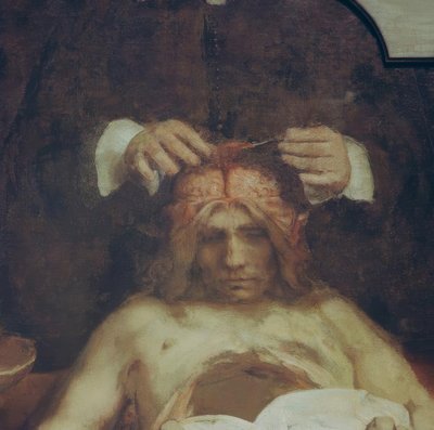 博士の解剖学ヨハン・デイマン 作： Rembrandt van Rijn
