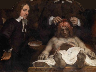 ヤンデイマン博士の解剖学レッスン、1656年 作： Rembrandt van Rijn