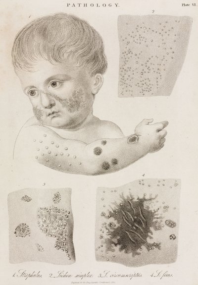 皮膚科学 皮膚疾患の種類 作： John Pardon