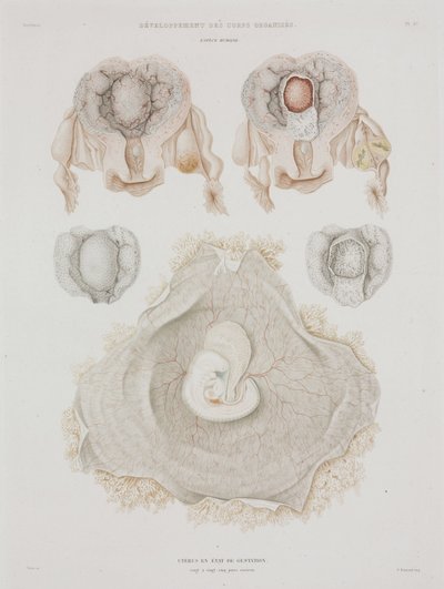 婦人科 胎児のいる人間の子宮 1847-1859年頃 作： John Pardon