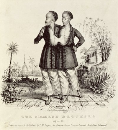 18歳のシャム兄弟、チャールズハルマンデル（1789〜1850年）、1829年頃 作： Thomas Mann Baynes