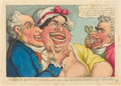 義歯と口蓋の標本を見せているフランスの歯科医 作： Thomas Rowlandson