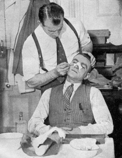 イングランドのキャプテン、エディハプグッドは、1934年のイタリアとの試合後に鼻骨折の治療を受けました。 作： Topical Press Agency