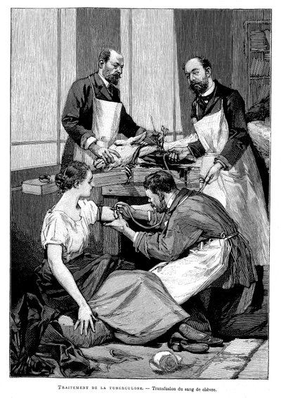 1891年に山羊の輸血を受けた結核患者 作： Unbekannt
