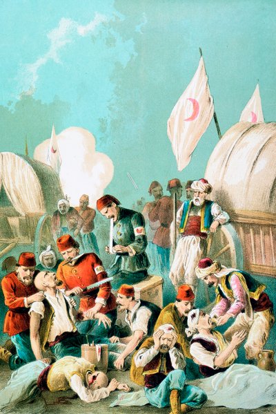 麻酔なしで切断された腕、露土戦争、1877 年 作： Unbekannt