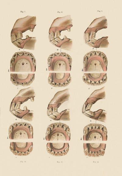 歯によって示される、年齢を示すプレートの説明、c1879。 作： Unbekannt
