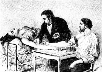 1882年にボランティアから女性に直接輸血を行ったジュネーブのRoussell博士 作： Unbekannt