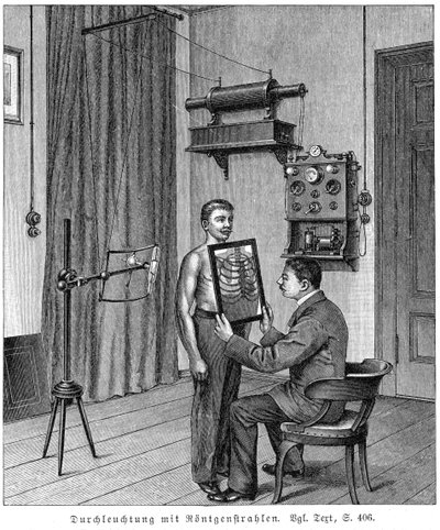 X線管と蛍光スクリーンを使用して患者の胸部を検査する、1903 作： Unbekannt