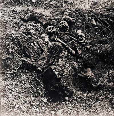 人間の遺体、c1914-c1918 作： Unbekannt