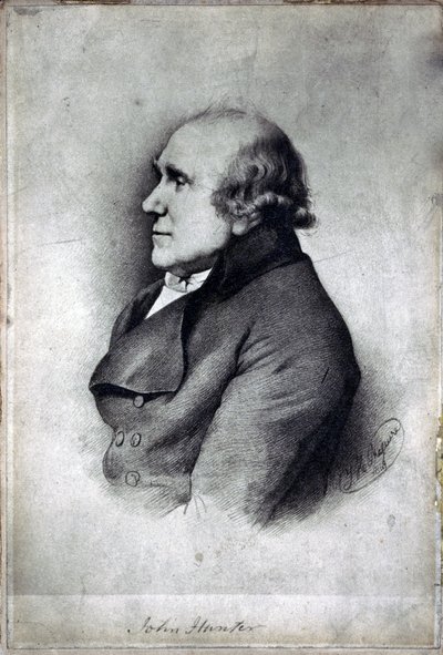 ジョン・ハンター（イギリスの外科医・解剖学者）1770年代頃 作： Unbekannt