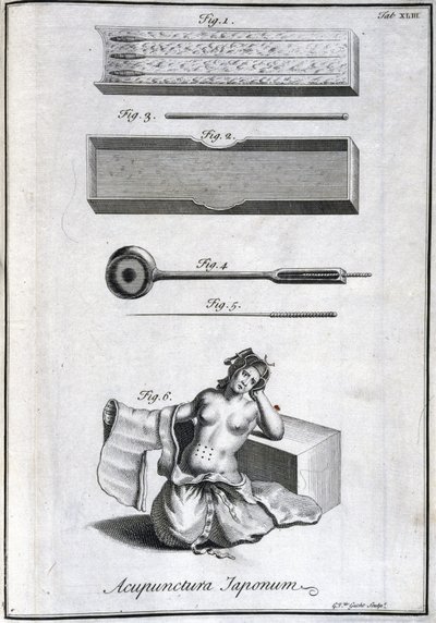 Medecine alternative : planche representant les aiguilles d