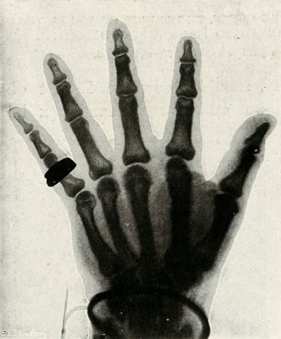 HRHの手の放射線写真、プリンスオブウェールズ、c1897 作： Unbekannt
