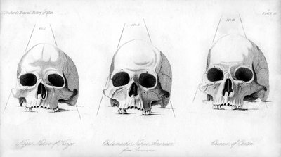3つのタイプの人間の頭蓋骨、1848 作： Unbekannt