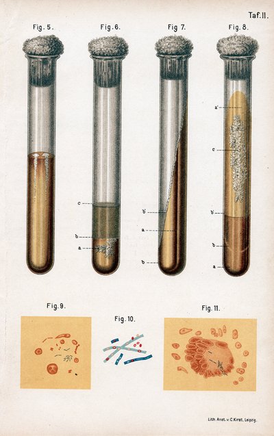 さまざまな種類の細菌、1889 作： Unbekannt