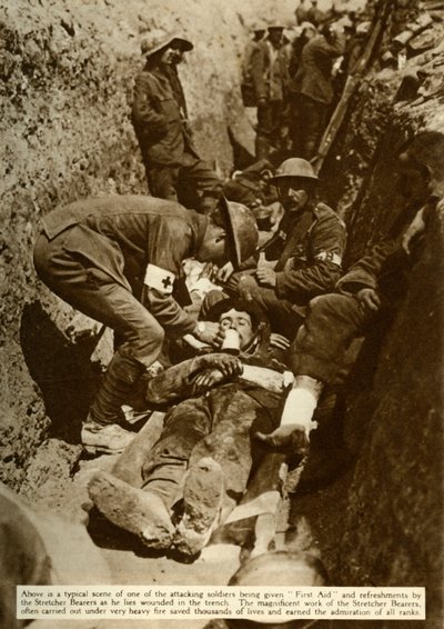 トレンチで扱われている負傷した兵士、ソンムの戦い、第一次世界大戦、1916年、1935年。 作： Unbekannt