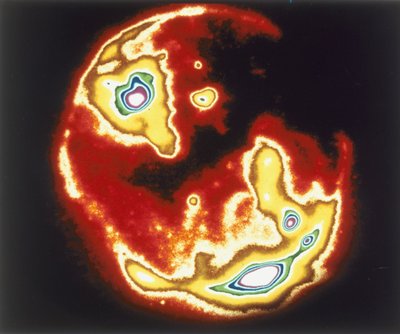 太陽のX線画像、スカイラブ、1970年代 作： Unbekannt