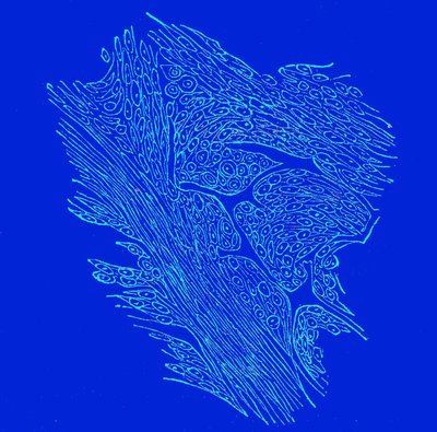 線維性核腫瘍の横断面 作： Unbekannter Künstler