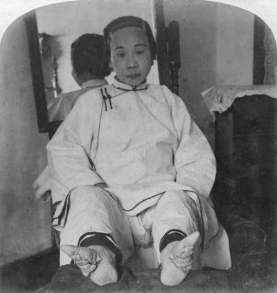 高いカーストの女性は、可愛らしいユリの足、奇形の方法を示しています、中国、1900。 作： Underwood and Underwood