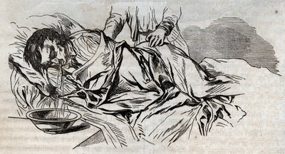 事故医学-溺れた人に与える最も効果的な救済について-クルミのおしめを横にして、飲んだ水を吐く-1852年「La Sante Universelle - Guide Medical des Familles」の刻印 作： Unknown artist