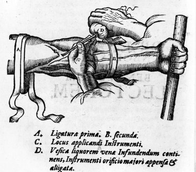 解剖学的ボード: 異なる結紮。ウィリアム・ハーヴェイ（1578-1657）、イギリスの医師による血液システムに関する研究。静脈を介した体内の血液循環を説明した。 作： Unknown artist