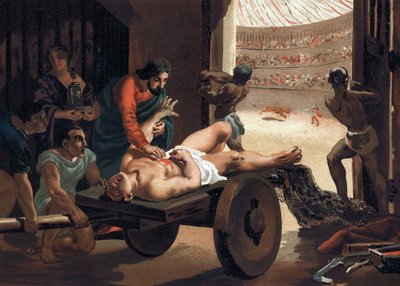 クロード・ガリアン（Klaudios Galenos or Claudio Galeno or Claudius Galenus or Galen, v.131 - v.201）、剣闘士を治療するギリシャ人医師。バルセロナ 1881 作： Unknown artist