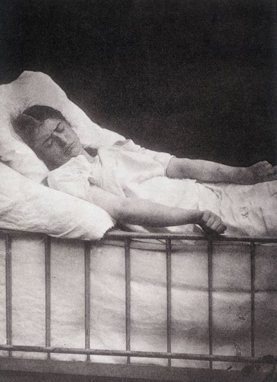 Hystero Epilepsie - Paul Regnard and Bournevilleによる "Photographic iconography of Salpétrière: service of Mr Charcot "での破傷風の発作 作： Unknown artist