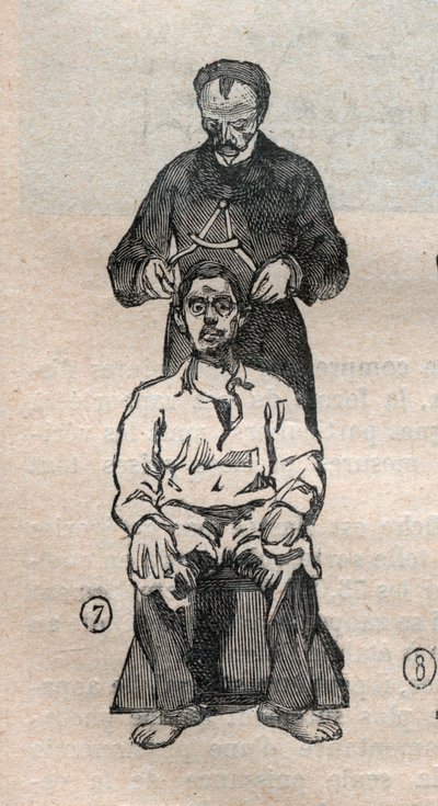 アルフォンス・ベルティヨン（1853-1914）の法医学的人体計測法（bertillonnage）：頭蓋骨の横方向の直径を測定する方法 - Engraving In "La Science francaise 作： Unknown artist