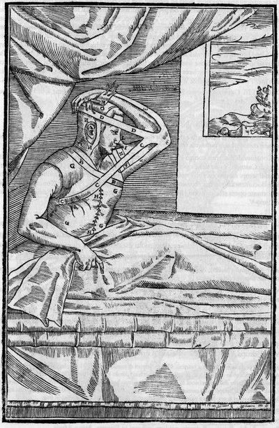 鼻の手術。De curtorum chirurgia per insitionem "の鼻の再建手術。ベニス 作： Unknown artist