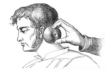 Saignee locales - リンゴを使ったヒルの塗布 - 1852年の "La Santo Universelle - Medical Guide for Families "に掲載された彫刻。 作： Unknown artist