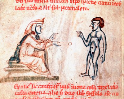 医者が患者の痛いところを熱したアイロンで焼くミニチュア 「De Medicina cauteriorum secundum Brunum, Rugerium et Rolthe」写本より 13世紀 Paris, B.N. 作： Unknown artist