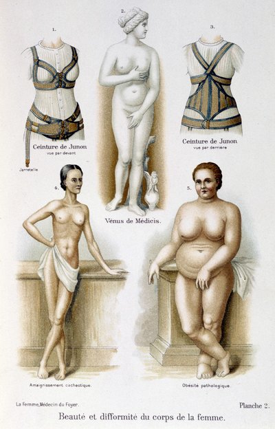 女性の体の美しさと奇形（痩せ型と肥満）；ジュノのベルト-"The woman, home doctor "にて 作： Unknown artist