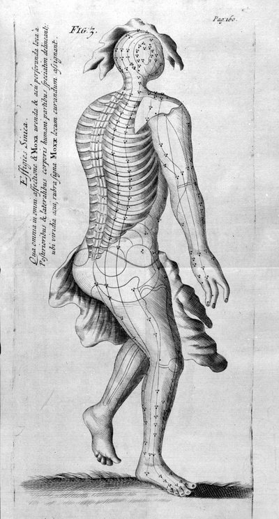 De Acupunctura by W.Ten Rhijne.ロンドン1683年。鍼灸を扱った最初の西洋文献。 作： Unknown artist