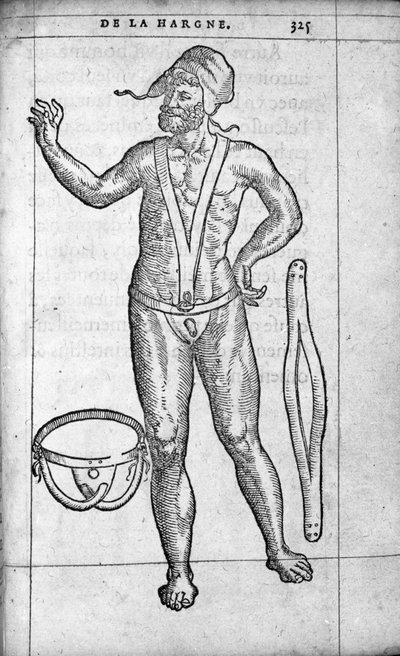 医学：ヘルニアベルト。フランスの医師・外科医であるAmbroise Pare（1509-1590）の「De la hargne」からのエングレーヴィング 16世紀 作： Unknown artist