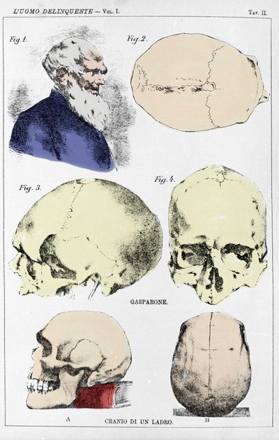 イタリアの犯罪学者による非行少年の頭蓋骨の形態に関する研究 作： Unknown artist
