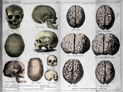 天才的な男の皮と頭脳。"天才の男 "におけるイタリアの犯罪学者チェーザレ・ロンブローゾ（1835-1909）の研究 作： Unknown artist