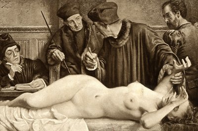 ウィッチクラフト科学者たちは、魔女の体にあるほくろをつまんで反応を調べるために探している。イラストはE.Van Hoove。1888 作： Unknown artist