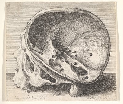 頭蓋骨の左側が取り除かれた、左側が横から見た断面の頭蓋骨、1651年。 作： Wenceslaus Hollar